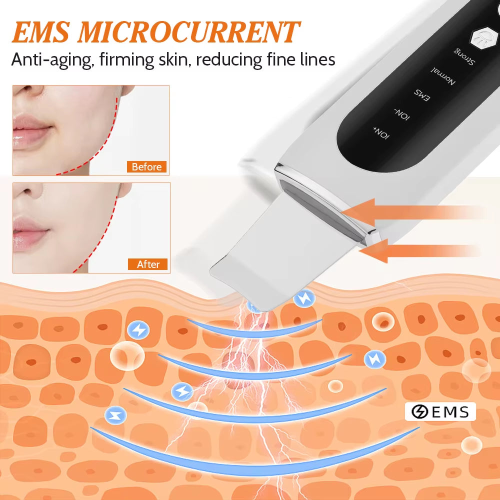 Ultrasonic Face Skin Scrubber Facial Peeling Skin Blackhead Remover Deep Face Cleaning Ultrasonic Ion Acne Pore Cleaner Facial